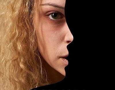 مشاهدة مسلسل Orphan Black الموسم الخامس الحلقة 4